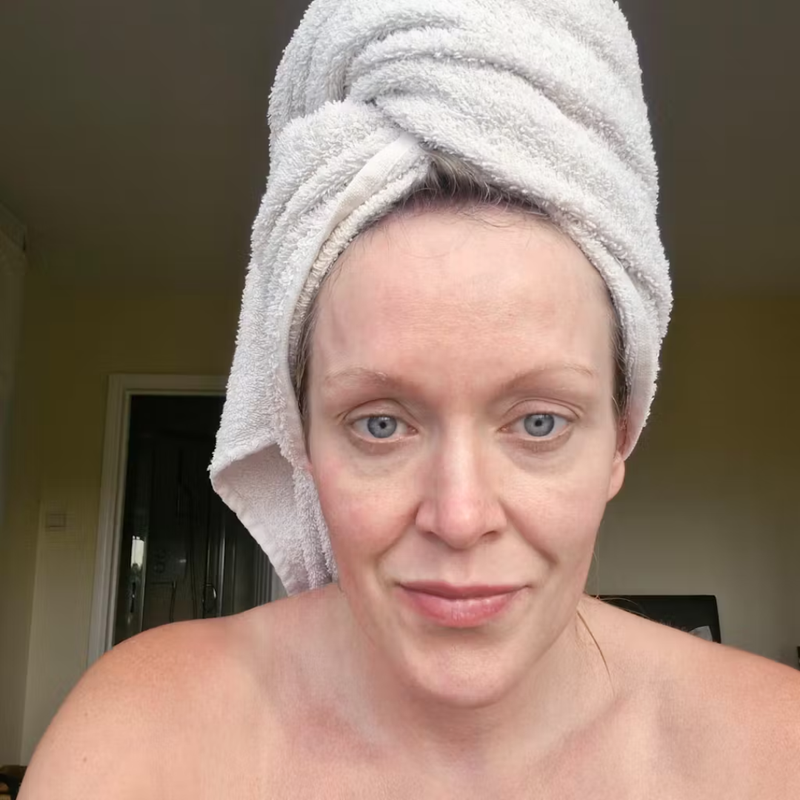 Before - Rainy