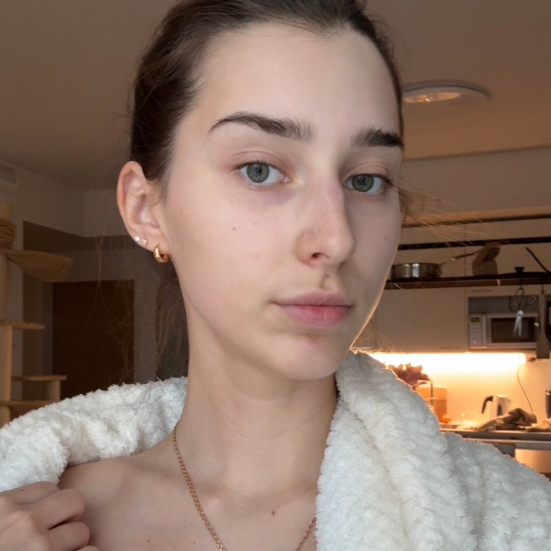 Before - Tetyana